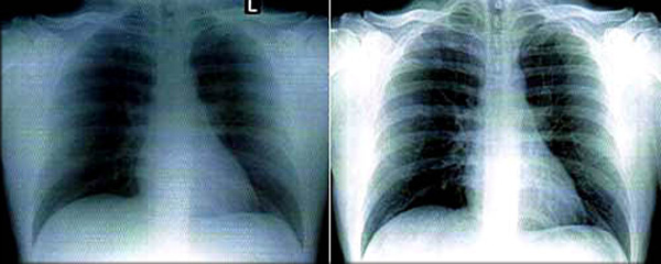 compare x-rays
